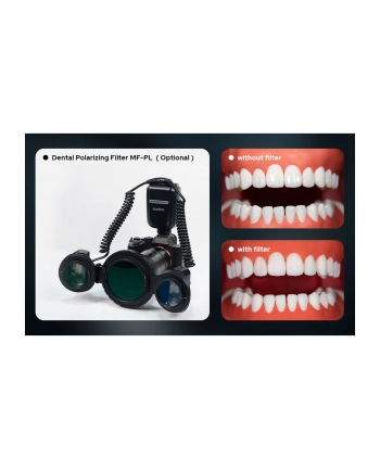 Godox MF-PL Dental Pol filtr do MF-T76 nr 1